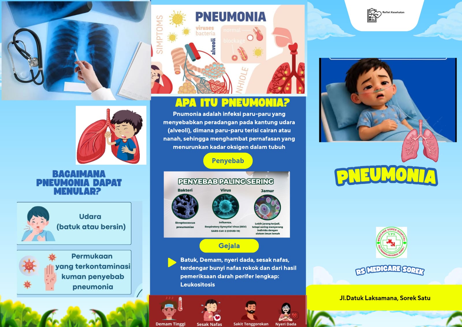 Pneumonia